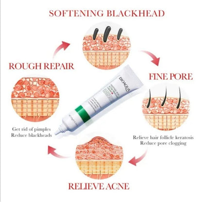 BIOAQUA Salicylic Acid Acne Removal Cream 20g