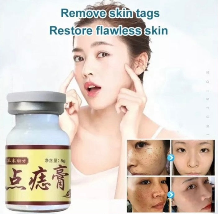 Apgar Herbal Skin Tag Removal Cream 5g